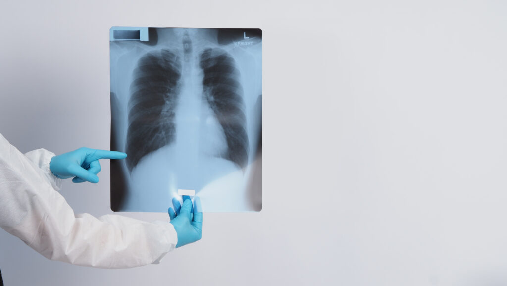 A healthcare professional conducting a chest X-ray as part of the tuberculosis (TB) test required for UK Skilled Worker visa applicants in 2025.